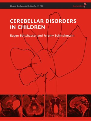 cover image of Cerebellar Disorders in Children